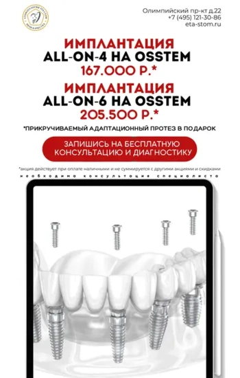 🔥 Имплантация «Все на 4» и «Все на 6» в ЭТА-СТОМ! 🔥