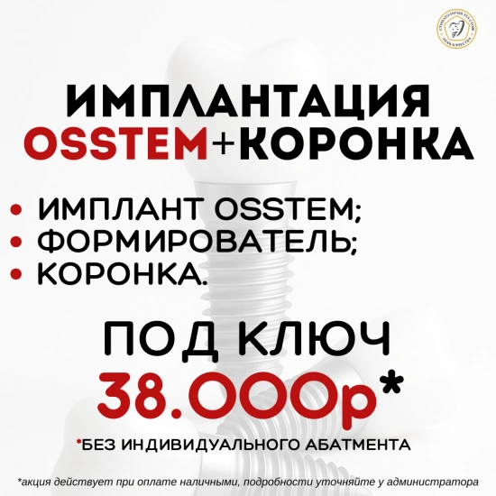 Акция на установку имплантатов OSSTEM «под ключ» - 38000 руб, вместо 58000 руб